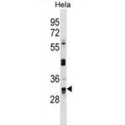 Probable U3 Small Nucleolar RNA-Associated Protein 11 (UTP11L) Antibody