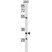 Ribosome Production Factor 2 Homolog (RPF2) Antibody