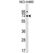 Polycystic Kidney Disease 2-Like 2 Protein (PKD2L2) Antibody
