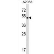 Zinc Finger Protein 559 (ZNF559) Antibody