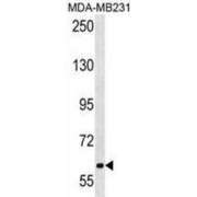 Short Transient Receptor Potential Channel 4-Associated Protein (TRPC4AP) Antibody