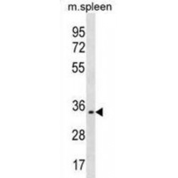 Trem-Like Transcript 1 Protein (TREML1) Antibody