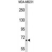 Zinc Finger Protein 44 (ZNF44) Antibody
