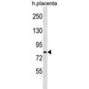 Probable E3 Ubiquitin-Protein Ligase HECTD2 (HECTD2) Antibody