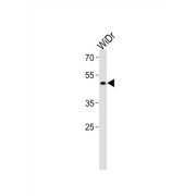 Transcription Factor Dp Family Member 3 (TFDP3) Antibody