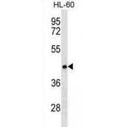 Protein CLN8 (CLN8) Antibody