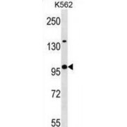 Kelch-Like Protein 4 (KLHL4) Antibody
