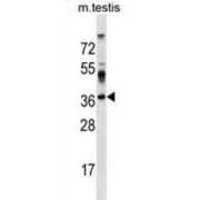 Surfeit 4 (SURF4) Antibody