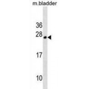 Tumor Protein D52 Like 1 (TPD52L1) Antibody