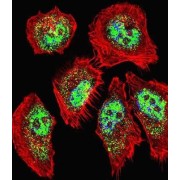 Zinc Fingers And Homeoboxes Protein 2 (ZHX2) Antibody