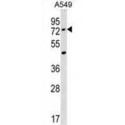 Acyl-CoA Synthetase Medium-Chain Family Member 2A (ACSM2A) Antibody