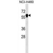 Ankyrin Repeat And Death Domain-Containing Protein 1B (ANKDD1B) Antibody