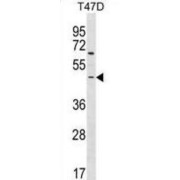 Rho Guanine Nucleotide Exchange Factor 35 (ARHGEF35) Antibody