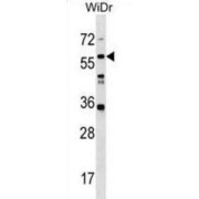 Leucine-Rich Repeat-Containing Protein 14B (LRRC14B) Antibody