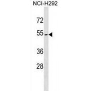Zona Pellucida-Like Domain-Containing Protein 1 (ZPLD1) Antibody