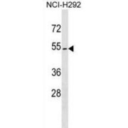 Zona Pellucida-Like Domain-Containing Protein 1 (ZPLD1) Antibody