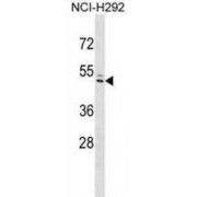 Interferon Induced Protein 44-Like (IFI44L) Antibody