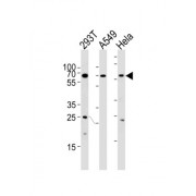 Heat Shock Factor Protein 2 (HSF2) Antibody