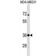 Syntaxin-4 (STX4) Antibody