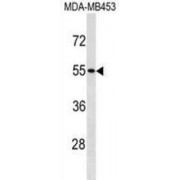 Src Kinase Associated Phosphoprotein 1 (SKAP1) Antibody