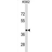 Poly(RC) Binding Protein 1 (PCBP1) Antibody