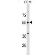 Fibroblast Growth Factor Receptor Substrate 2 (FRS2) Antibody