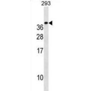 Triggering Receptor Expressed On Myeloid Cells 1 (TREM1) Antibody