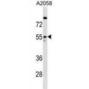 abx030592