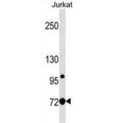 Lymphocyte Cytosolic Protein 1 (LCP1) Antibody