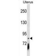 Protocadherin Gamma-B4 (PCDHGB4) Antibody