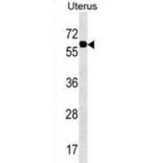 Phosphoacetylglucosamine Mutase (PGM3) Antibody