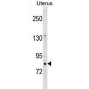 Zinc Finger Protein 853 (ZNF853) Antibody