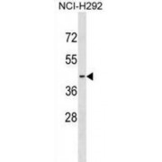 Sphingosine 1-Phosphate Receptor 2 (S1PR2) Antibody