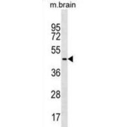 Fas Associated Factor Family Member 2 (FAF2) Antibody