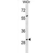 Growth Arrest Specific Protein 2 (GAS2) Antibody