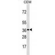 Olfactory Receptor 3A3 (OR3A3) Antibody
