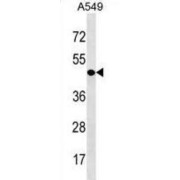 Chromodomain Y-Linked 1 (CDY1) Antibody