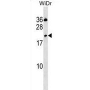 C-Type Lectin Domain Family 2 Member D (CLEC2D) Antibody