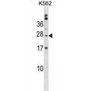 Polyadenylate-Binding Protein 1-Like 2 (PABPC1L2B) Antibody