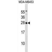 Inosine Triphosphate Pyrophosphatase (ITPA) Antibody