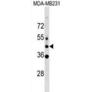 Membrane Protein MLC1 (MLC1) Antibody
