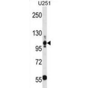 Thrombospondin 3 (THBS3) Antibody
