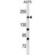 RNA Polymerase I Subunit A (POLR1A) Antibody