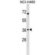 Alpha-N-Acetyl-Neuraminyl-2,3-Beta-Galactosyl-1,3-N-Acetyl-Galactosaminide Alpha-2,6-Sialyltransferase (ST6GALNAC4) Antibody