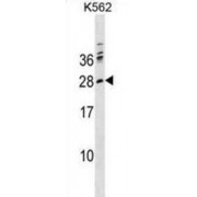WB analysis of K562 cell line lysates.