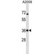 Calcium Homeostasis Modulator Protein 3 (CALHM3) Antibody