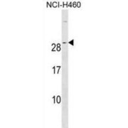 Ras-Related Protein Ral-A (RALA) Antibody