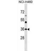N-Acetyltransferase 6 (NAT6) Antibody