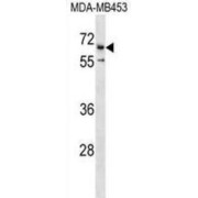 Cation Channel Sperm Associated 2 (CATSPER2) Antibody