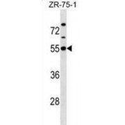 Potassium Inwardly Rectifying Channel Subfamily J, Member 1 (KCNJ1) Antibody